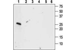 Western blot analysis using Anti-proBDNF Antibody (ABIN7043558, ABIN7044753 and ABIN7044754), (1:400):1. (Pro-Brain-Derived Neurotrophic Factor (proBDNF) Peptid)