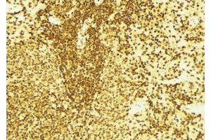 Immunohistochemistry (IHC) image for anti-Docking Protein 1, 62kDa (Downstream of tyrosine Kinase 1) (DOK1) (Internal Region) antibody (ABIN6263984)