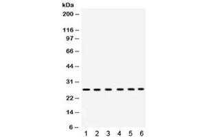 Western blot testing of 1) rat heart, 2) rat liver, 3) mouse liver, 4) human placenta, 5) COLO320 and 6) HeLa lysate with EIF3A antibody. (EIF6 Antikörper  (AA 66-210))