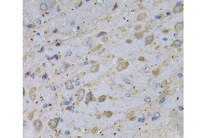 Immunohistochemistry of paraffin-embedded Rat brain using GAD2 Polyclonal Antibody at dilution of 1:100 (40x lens). (GAD65 Antikörper)