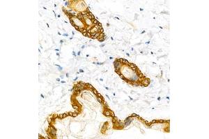 Immunohistochemistry analysis of paraffin embedded mouse skin using CK6 (ABIN7074423) at dilution of 1: 1000 (Keratin 6 Antikörper)