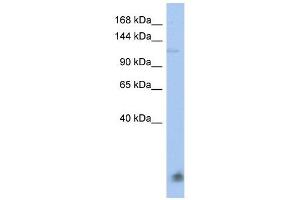 HERC5 antibody used at 1 ug/ml to detect target protein. (HERC5 Antikörper  (N-Term))