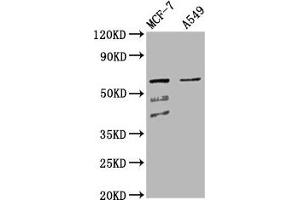 Western Blot Positive WB detected in: MCF-7 whole cell lysate, A549 whole cell lysate All lanes: SLC22A5 antibody at 4. (SLC22A5 Antikörper  (AA 42-142))