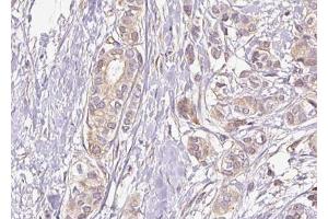 Immunohistochemistry (IHC) image for anti-Nuclear Factor of kappa Light Polypeptide Gene Enhancer in B-Cells 1 (NFKB1) (pSer337) antibody (ABIN6256276)
