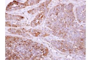 IHC-P Image Talin 1 antibody [C3], C-term detects TLN1 protein at cytosol on H357 xenograft by immunohistochemical analysis. (TLN1 Antikörper  (C-Term))