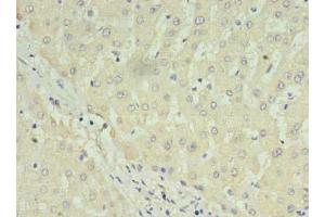 Immunohistochemistry of paraffin-embedded human liver tissue using ABIN7175057 at dilution of 1:100 (C1ORF123 Antikörper  (AA 1-160))