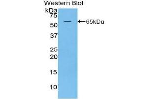 Detection of Recombinant MAP2, Rat using Polyclonal Antibody to Microtubule Associated Protein 2 (MAP2) (MAP2 Antikörper  (AA 1459-1718))