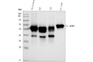 Western blot analysis of AHSG using anti-AHSG antibody (ABIN3043534). (Fetuin A Antikörper  (N-Term))