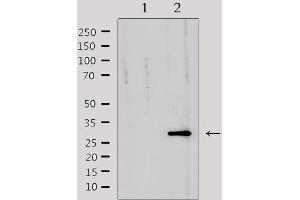 Western Blotting (WB) image for anti-Tumor Necrosis Factor Receptor Superfamily, Member 6b, Decoy (TNFRSF6B) antibody (ABIN6265644)