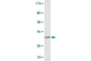 Western Blot detection against Immunogen (36. (CACNA1I Antikörper  (AA 233-331))