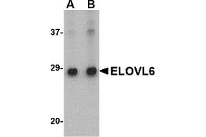 Western Blotting (WB) image for anti-ELOVL Fatty Acid Elongase 6 (ELOVL6) (N-Term) antibody (ABIN1031365) (ELOVL6 Antikörper  (N-Term))