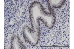 Immunoperoxidase of monoclonal antibody to ZNF24 on formalin-fixed paraffin-embedded human endometrium. (ZNF24 Antikörper  (AA 1-368))