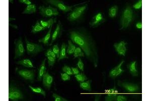 Image no. 2 for anti-serum/glucocorticoid Regulated Kinase 1 (SGK1) (AA 1-432) antibody (ABIN598922) (SGK1 Antikörper  (AA 1-432))
