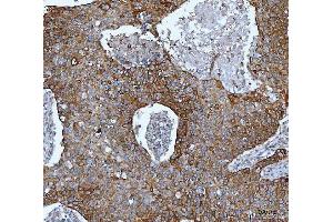 IHC analysis of IMPDH2 using anti-IMPDH2 antibody (ABIN7603063).