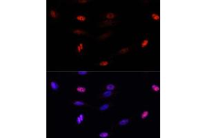 Immunofluorescence analysis of U-2 OS cells using SUMO3 antibody (ABIN7270371) at dilution of 1:100. (SUMO3 Antikörper  (AA 1-92))
