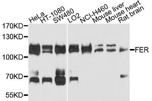 Western blot analysis of extracts of various cell lines, using FER antibody. (FER Antikörper)