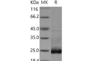 Western Blotting (WB) image for Podoplanin (PDPN) protein (His tag) (ABIN7320345) (Podoplanin Protein (PDPN) (His tag))