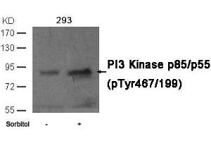 Western blot analysis of extracts from 293 cells untreated or treated with sorbitol using PI3 Kinase p85/p55 (phospho-Tyr467/199)Antibody. (PIK3R1/PIK3R3 Antikörper  (pTyr467))