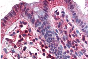 Human Colon (formalin-fixed, paraffin-embedded) stained with TNFRSF17 antibody ABIN351451 at 3 ug/ml followed by biotinylated goat anti-rabbit IgG secondary antibody ABIN481713, alkaline phosphatase-streptavidin and chromogen. (BCMA Antikörper  (C-Term))