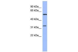DDC antibody used at 1 ug/ml to detect target protein. (DDC Antikörper)
