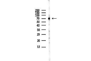 anti-Heat Shock 70kDa Protein 1A (HSPA1A) (C-Term) antibody