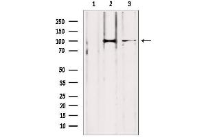 Western blot analysis of extracts from various samples, using LONP1 antibody. (LONP1 Antikörper  (C-Term))