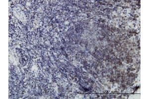 Immunoperoxidase of monoclonal antibody to EPHB3 on formalin-fixed paraffin-embedded human lymph node. (EPH Receptor B3 Antikörper  (AA 899-997))