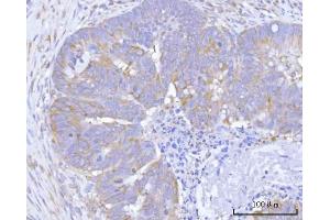 IHC analysis of Hamartin/TSC1 using anti-Hamartin/TSC1 antibody (ABIN7599499). (TSC1 Antikörper  (AA 1-618))