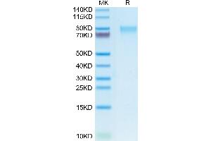SDS-PAGE (SDS) image for Guanylate Cyclase 2C (Heat Stable Enterotoxin Receptor) (GUCY2C) (AA 24-430) protein (His-Avi Tag) (ABIN7274716)