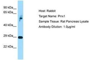 Image no. 1 for anti-Paired Related Homeobox 1 (PRRX1) (C-Term) antibody (ABIN6749858) (PRRX1 Antikörper  (C-Term))
