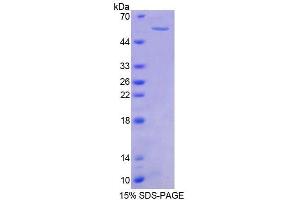 SDS-PAGE analysis of Mouse PTK2b Protein. (PTK2B Protein)