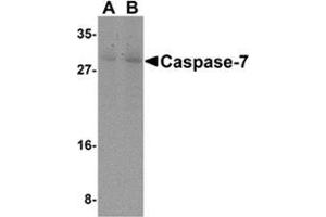Western blot analysis of Caspase-7 in mouse skeletal muscle cell lysate with Caspase-7 antibody at (A) 0. (Caspase 7 Antikörper  (N-Term))