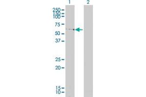 Western Blot analysis of LSM16 expression in transfected 293T cell line by LSM16 monoclonal antibody (M01A), clone 4E3-3A4. (EDC3 Antikörper  (AA 1-508))