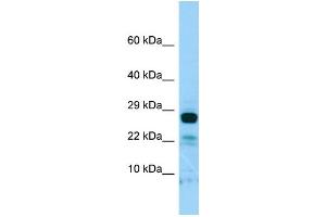 WB Suggested Anti-IL22RA2 Antibody Titration: 1. (IL22RA2 Antikörper  (C-Term))