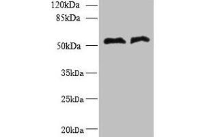 Western blot All lanes: TRIT1 antibody at 3 μg/mL Lane 1: Jurkat whole cell lysate Lane 2: Raji whole cell lysate Secondary Goat polyclonal to rabbit IgG at 1/10000 dilution Predicted band size: 53, 38, 50, 44, 19 kDa Observed band size: 53 kDa