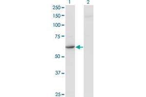 Western Blot analysis of CDR2 expression in transfected 293T cell line by CDR2 monoclonal antibody (M03), clone 4D2. (CDR2 Antikörper  (AA 1-454))
