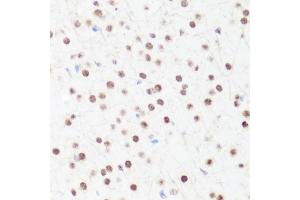 Immunohistochemistry of paraffin-embedded mouse brain using MonoMethyl-Histone H4-R3 antibody (ABIN1680263, ABIN1680264, ABIN6220110 and ABIN6220114) at dilution of 1:100 (40x lens). (Histone H4 Antikörper  (meArg3))