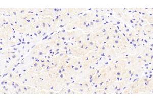 Detection of IkBa in Human Cardiac Muscle Tissue using Polyclonal Antibody to Inhibitory Subunit Of NF Kappa B Alpha (IkBa) (Inhibitory Subunit Of NF kappa B alpha (AA 74-247) Antikörper)