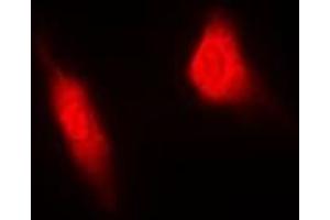 Immunofluorescent analysis of MGCRACGAP staining in HeLa cells. (RACGAP1 Antikörper)