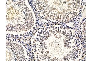 ABIN7096438 and ABIN7100502 at 1/100 staining rat testis tissue by IHC-P. (GRAMD1B Antikörper)