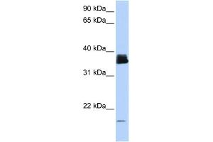 WB Suggested Anti-PPIA Antibody Titration:  0. (PPIA Antikörper  (N-Term))