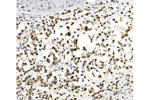 IHC analysis of JUNB using anti-JUNB antibody (ABIN7603223). (JunB Antikörper  (N-Term))