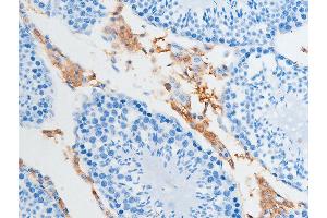 ABIN6267252 at 1/100 staining rat testicular tissue sections by IHC-P.