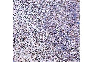 IHC analysis of PPA2 using anti-PPA2 antibody (ABIN6719431).