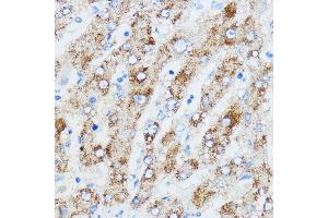 Immunohistochemistry of paraffin-embedded human liver using IGF2BP3 antibody (ABIN6131800, ABIN6142245, ABIN6142246 and ABIN6221706) at dilution of 1:100 (40x lens). (IGF2BP3 Antikörper  (AA 300-579))