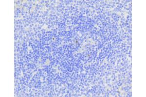 Immunohistochemistry (IHC) image for anti-Caspase 3 (CASP3) antibody (ABIN4903137)