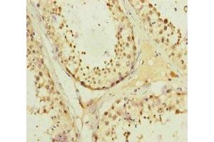 Immunohistochemistry of paraffin-embedded human testis tissue using ABIN7157660 at dilution of 1:100 (KIFC3 Antikörper  (AA 140-390))