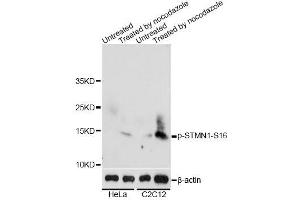 Western blot analysis of extracts of HeLa and C2C12 cells, using Phospho-STMN1-S16 antibody (ABIN2987668) at 1/2000 dilution. (Stathmin 1 Antikörper  (pSer16))