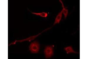 Immunofluorescence (fixed cells) (IF/ICC) image for anti-serpin Peptidase Inhibitor, Clade B (Ovalbumin), Member 7 (SERPINB7) (Internal Region) antibody (ABIN6258680)