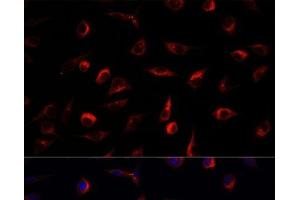 Immunofluorescence analysis of L929 cells using MAP2K7 Polyclonal Antibody at dilution of 1:100. (MAP2K7 Antikörper)